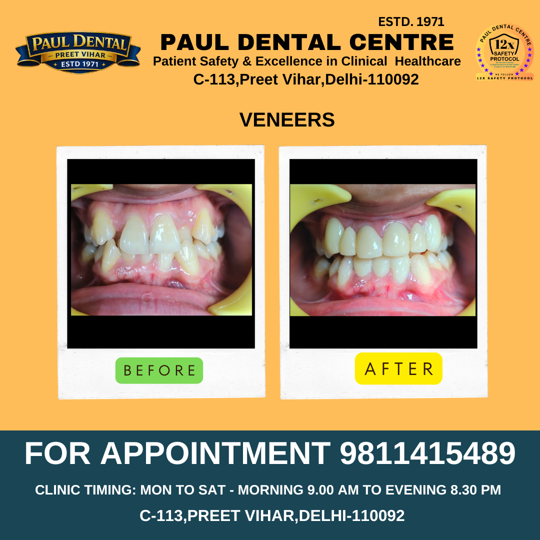 Case 25 – Paul Dental Center
